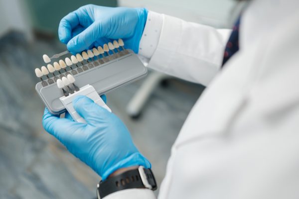 close up shot of dentist selecting the color of veneer