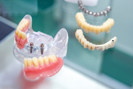 removable acrylic denture on plastic model